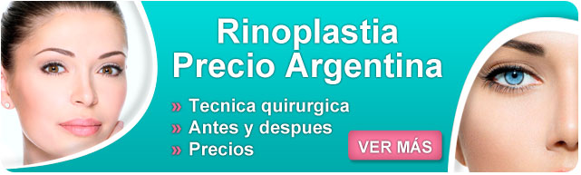 rinoplastia precio, costo de una rinoplastia, rinoseptoplastia postoperatorio, rinoplastia precio argentina, informacion complementaria, rinoplastia argentina precio, rinoplastia precios,